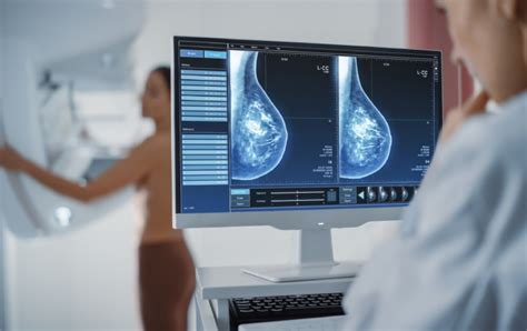 The deeper deets of Mammography explained!