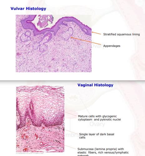 Disorders Of Vulva Vagina And Cervix Flashcards Quizlet