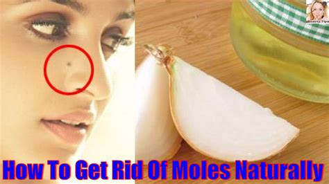 How To Get Rid Of Moles Naturally Youtube