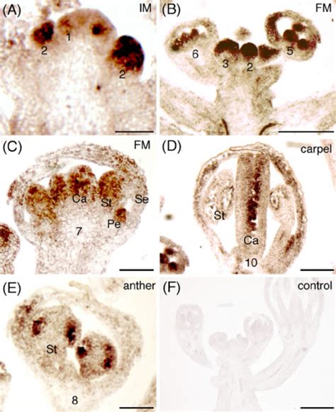 In Situ Hybridization Of Nsn1 Mrna In The Inflorescence Meristem Im