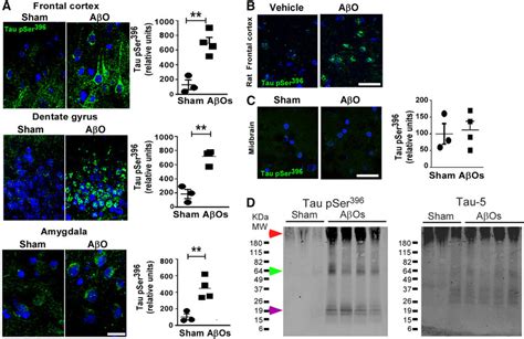 Aos Trigger Tau Phosphorylation In The Rat And Macaque Brains A