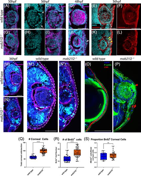 Zebrafish Mab21l2 Mutants Possess Severe Defects In Optic Cup