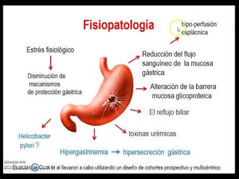 FSPTA. 2024. Parte 6.Lesiones gastricas por estres - YouTube