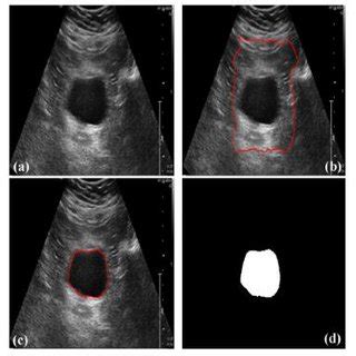 PDF Overview Of Segmentation X Ray Medical Images Using Image