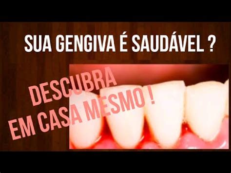 Como Saber Se A Gengiva Est Saud Vel Descubra Em Casa Youtube