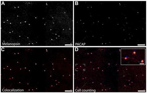 Staining For Melanopsin And Pacap Reveals That They Are Expressed In