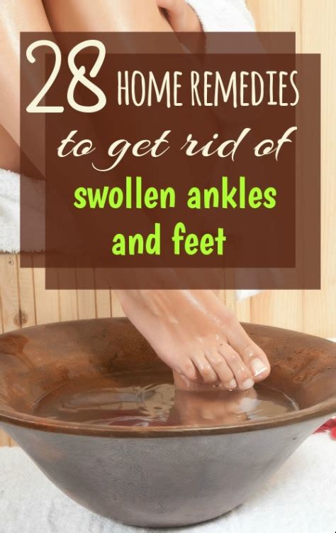 Home Remedy Hacks • 28 Home Remedies For Feet And Ankle Swelling