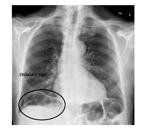 Imaging Case Of The Week 264 Answer Emergucate