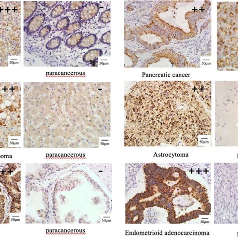 Immunohistochemistry Was Used To Detect The Expression Of Tight