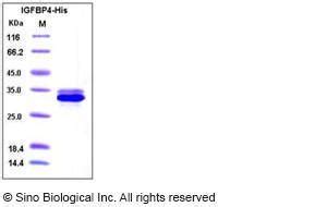 Human Recombinant Igfbp Protein His Tag From Hek Cells Vwr