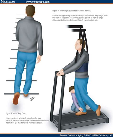 Physical Therapy For Parkinsons Gait - United Health Care Insurance Doctors