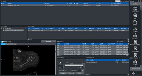 Logiciel médical ZedView LEXI Co TDM pour chirurgie de l