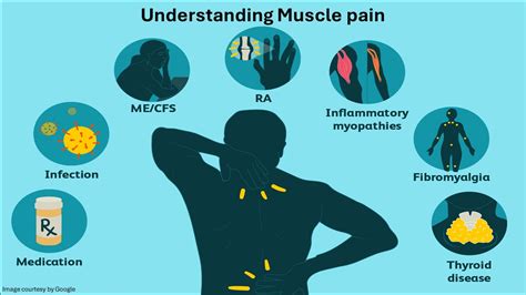 Say Goodbye to Muscle Pain: Expert Tips on Relief and Prevention