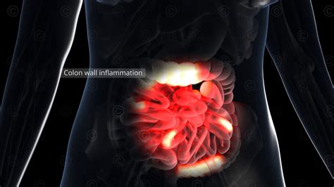 Animation Optoakustische Bildgebung MedicalGraphics