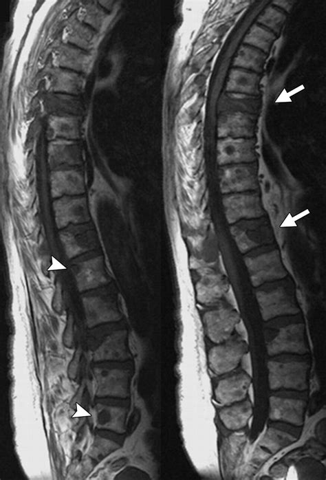 Integrated Imaging Approach To Osteoporosis State Of The Art Review