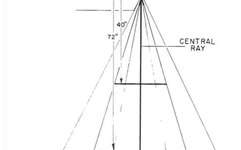 Anode Heel Effects. - radiologystar