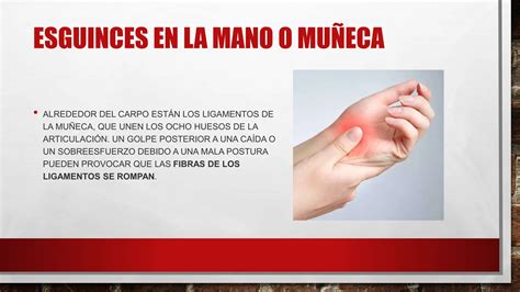 Lesiones Y Enfermedades De Mano Y De Mu Eca Pptx