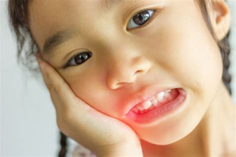 Preventing Tooth Abscesses Pediatric Dentist Fort Worth