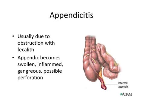 acute abdomen clinical   managementpptx