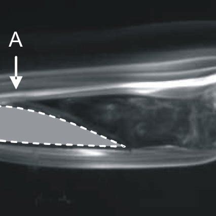 Flow visualization (Case 6) | Download Scientific Diagram