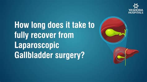 How Long Does It Take To Fully Recover From Laparoscopic Gallbladder