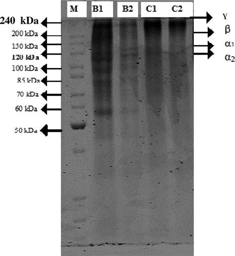 SDS Polyacrylamide Gel Electrophoresis SDS PAGE Image Of Gelatin M