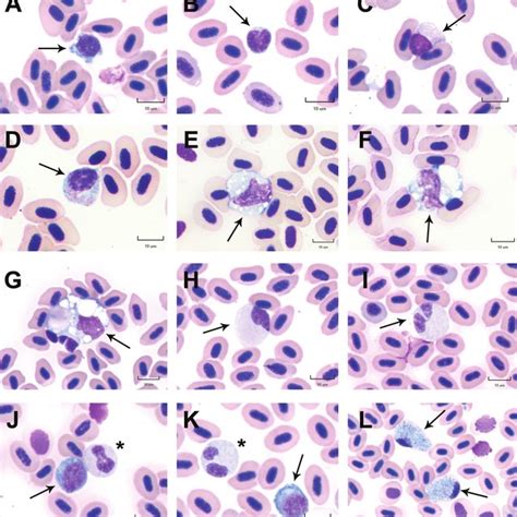 Pdf Stress Leukogram Induced By Acute And Chronic Stress In Zebrafish