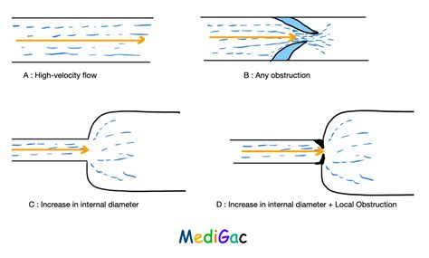 Cardiac Murmurs : Definition, Mechanisms, Grades, Types, Loudness – MediGac