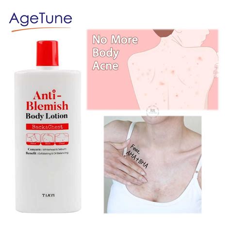 TIAM Anti Blemish Body Lotion Back & Chest (200 Ml) - Age Tune