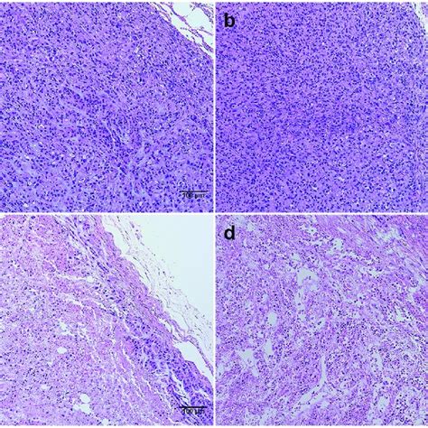 Hematoxylin And Eosin Stains Of Tumor Tissue Show Morphological Download Scientific Diagram