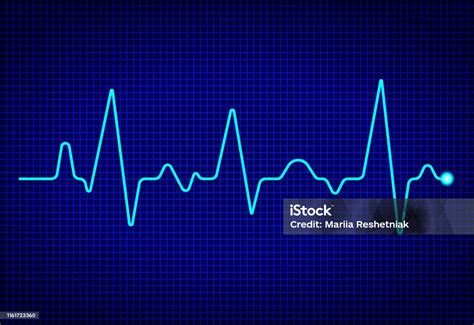 Monitor Denyut Jantung Dengan Sinyal Pada Latar Belakang Biru Tua Detak