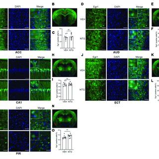 Repeated Ntg Injection Induced Migraine Related Behaviors And