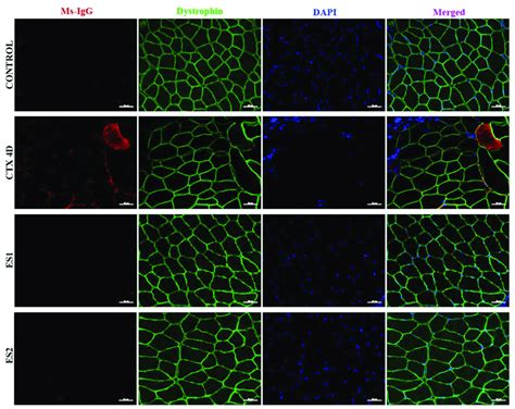 Representative Immunofluorescence Micrographs Of Igg Positive Red