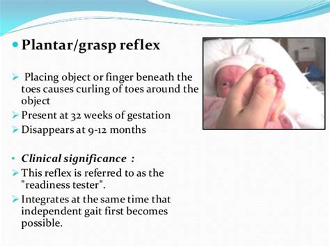 Plantar Grasp Reflex | Preventive dentistry, Plantar reflex, Reflexes