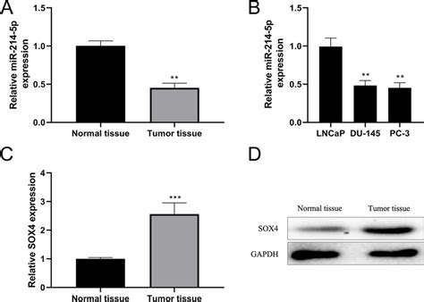 Expression Patterns Of Mirna P And Sox In Prostate Cancer Tissues