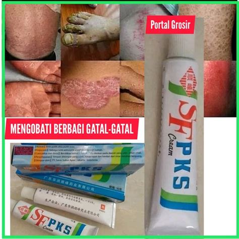 Jual Salep Sf Pks Cream Pikangshuang Salep Gatel Gatel Kl Bl Hl Pkw