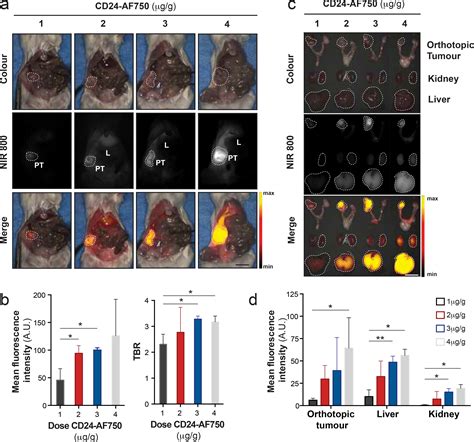 CD24 Targeted Intraoperative Fluorescence Image Guided Surgery Leads To