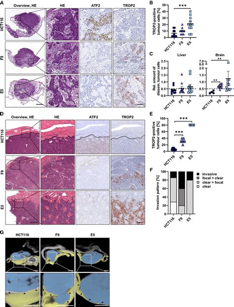 Atf Loss Enhances Invasion In Different Xenograft Models A