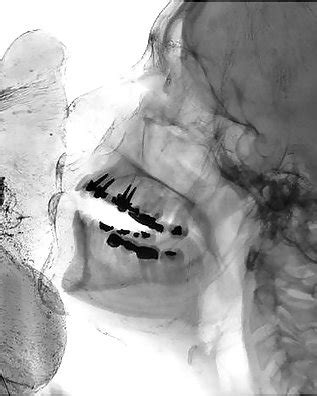 Sex Under Mri Or Xray Porn Pictures XXX Photos Sex Images