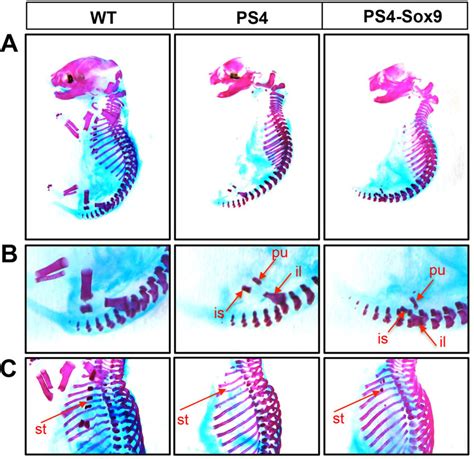 Sox9 overexpression fails to rescue skeletal development in ... 