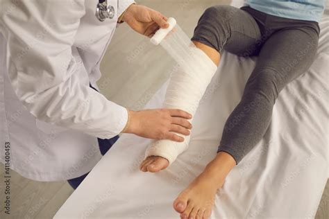 Cropped image doctor bandages the patient's broken leg with a bandage in the hospital. Doctor ...