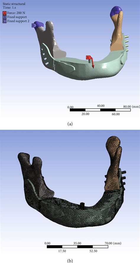 Figure 1 From The Use Of Customized Three Dimensionally Printed