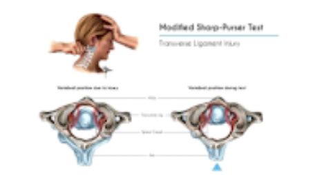 MSK Cervical Exam Flashcards Quizlet