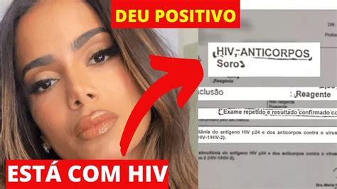 Anitta Faz Exame De HIV TESTOU POSITIVO A VERDADE APARECEU YouTube