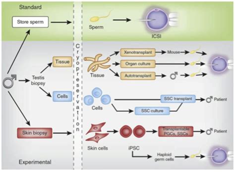 Testicular Tissue Cryopreservation The Oncofertility Consortium