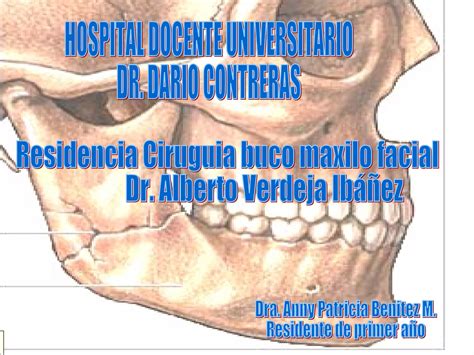 Fractura Mandibular Examen PPT