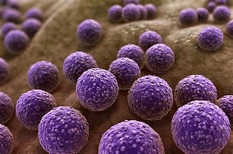 Mrsa Infeksi Akibat Bakteri Yang Semakin Resisten Terhadap Antibiotik