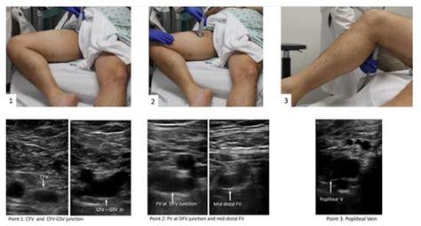 JCM Free Full Text The Use Of Point Of Care Ultrasound POCUS In