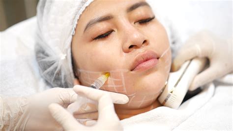 Mengurangi Lemak Wajah Dan Tubuh Dengan Meso Therapy Treatment Novis News