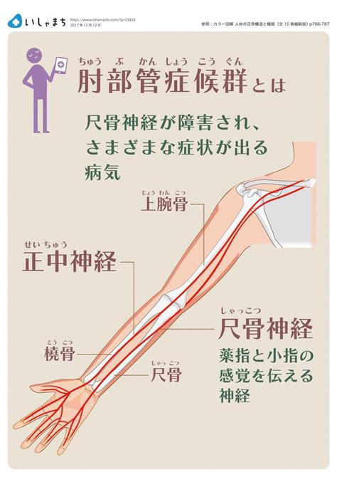 肘部管症候群とは Infographics 筋肉解剖学 漢方医学 神経系